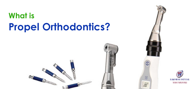 What is meant by Propel Orthodontics