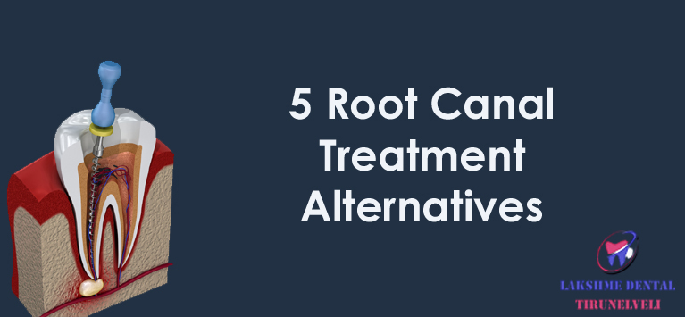 5 Root Canal Treatment Alternatives