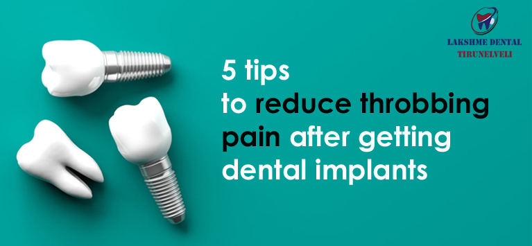 5 Tips to reduce throbbing pain after getting dental implants AS 18, 2020.docx