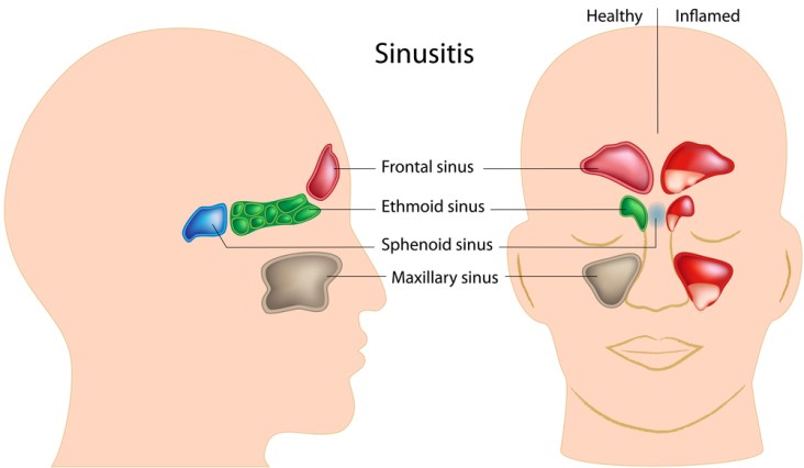 Sinus Cavity Anatomy