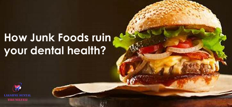 How junk foods affect our oral health?