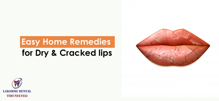 Easy Home Remedies for cracked lips