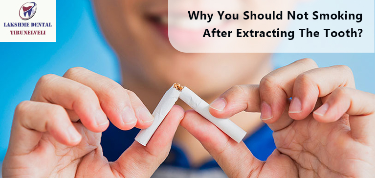 Why you should not smoke after removing a tooth?