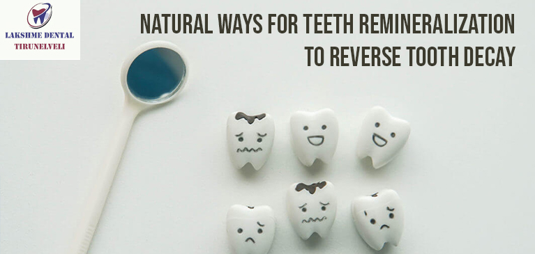 Natural ways for teeth remineralization to reverse tooth decay