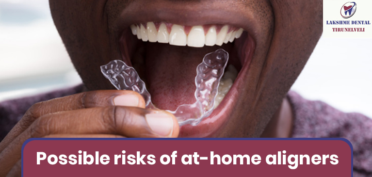 Possible risks of at-home aligners