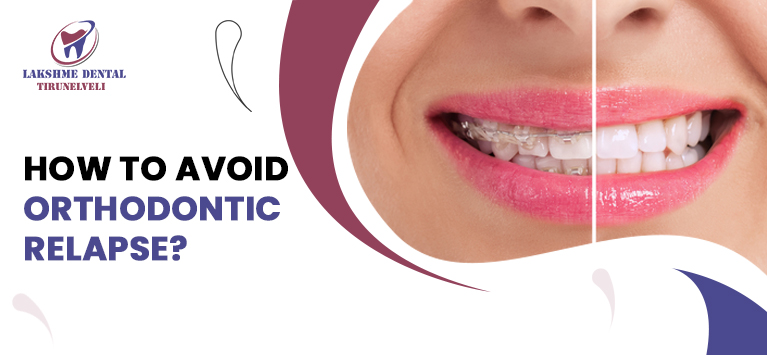 How to avoid Orthodontic Relapse?