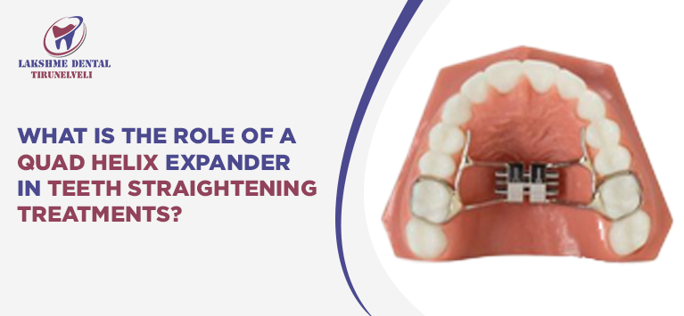 What is the role of a quad helix expander in teeth straightening treatments?