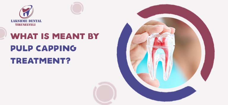What is meant by Pulp Capping Treatment?