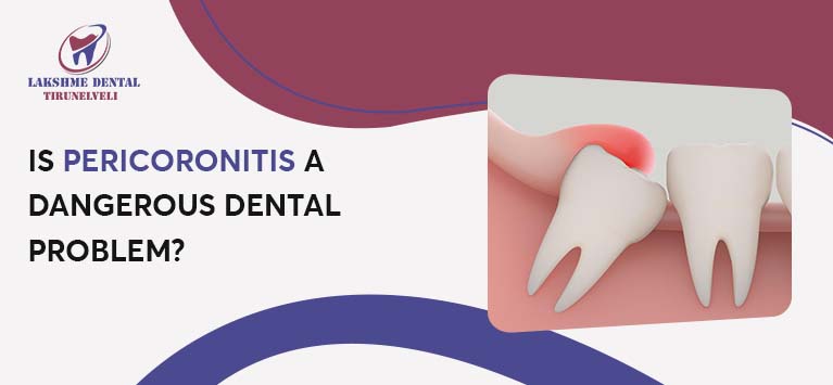 Is Pericoronitis a dangerous dental problem?