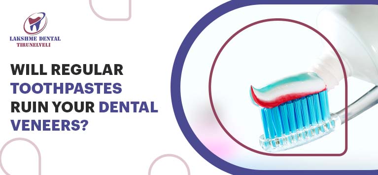 Will regular toothpastes ruin your dental veneers?