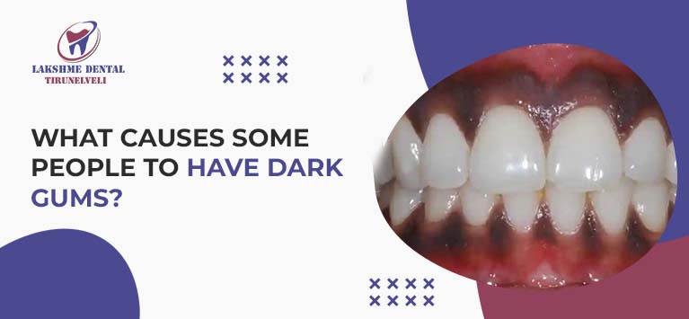 What causes some people to have dark gums?