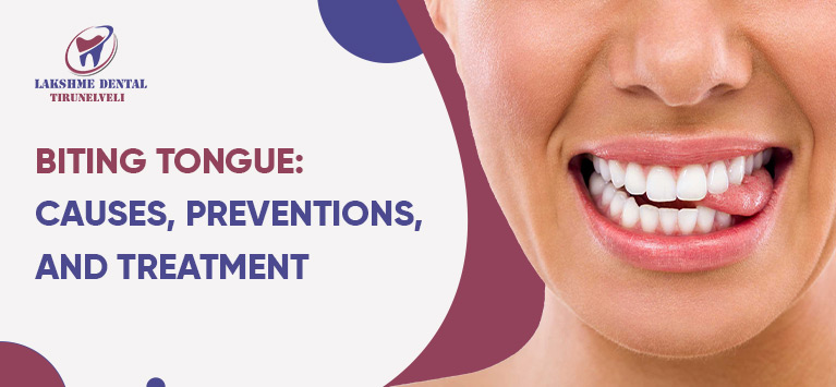 Biting tongue: causes, preventions, and treatment