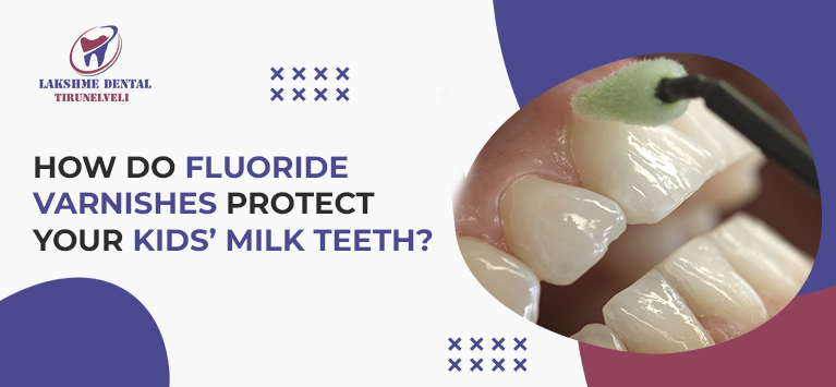 How do fluoride varnishes protect your kids’ milk teeth?