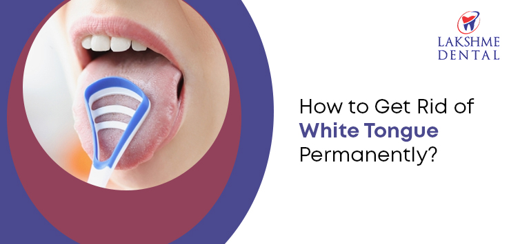 How to Get Rid of White Tongue Permanently?