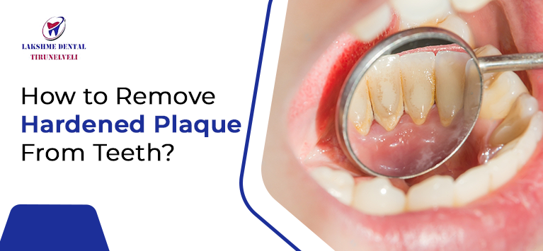 How to Remove Hardened Plaque From Teeth?