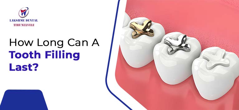How Long Can A Tooth Filling Last?