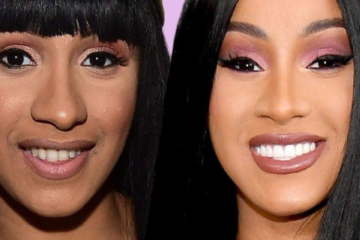 Cardi B Teeth Before & After