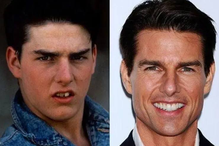 Tom Cruise Before & After