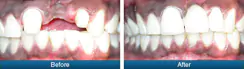 Before & After