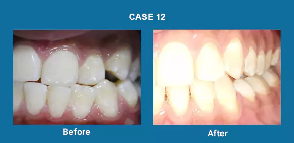 Before & After