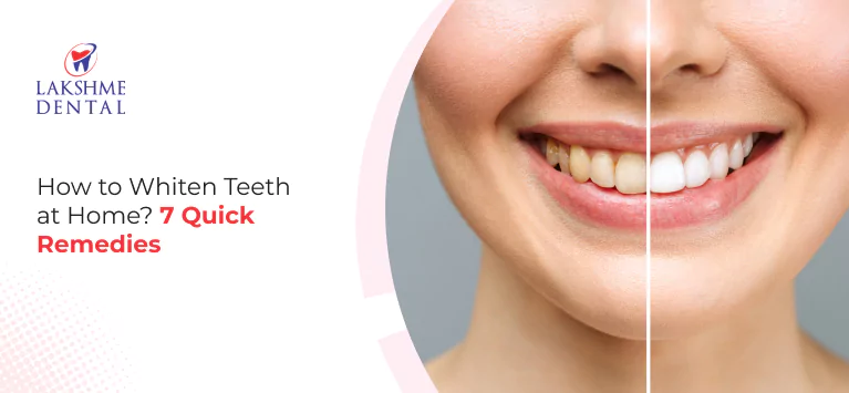 How to Whiten Teeth at Home?