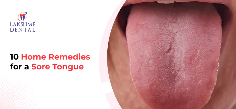 10 Home Remedies for a Sore Tongue