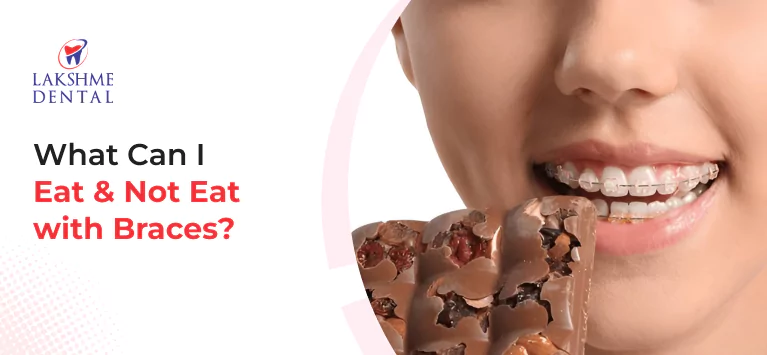 What Can I Eat & Not Eat with Braces?