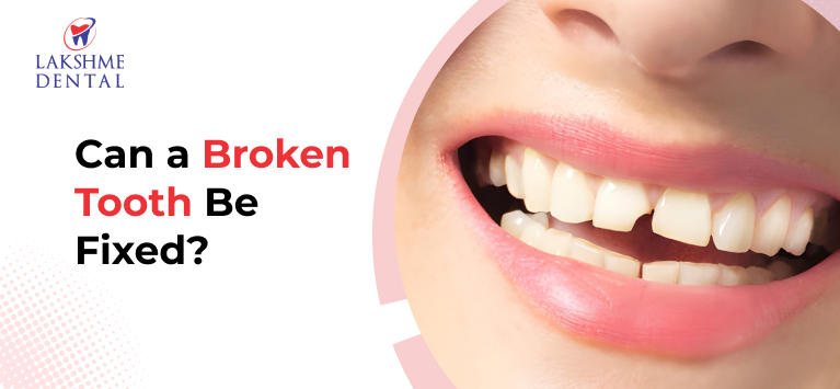 Can a Broken Tooth Be Fixed?