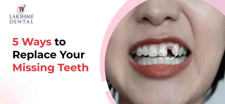 How to Replace Your Missing Teeth