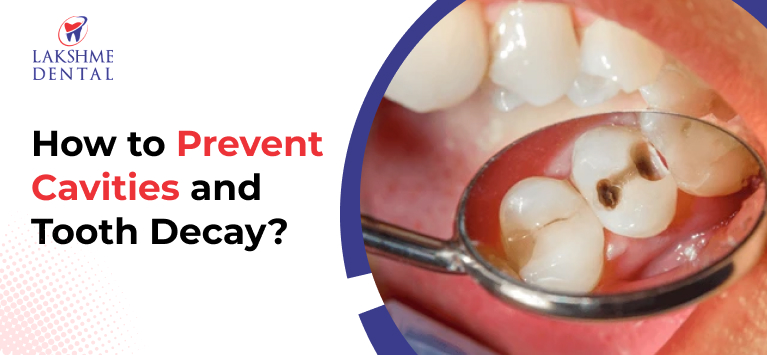 How to Prevent Cavities and Tooth Decay?