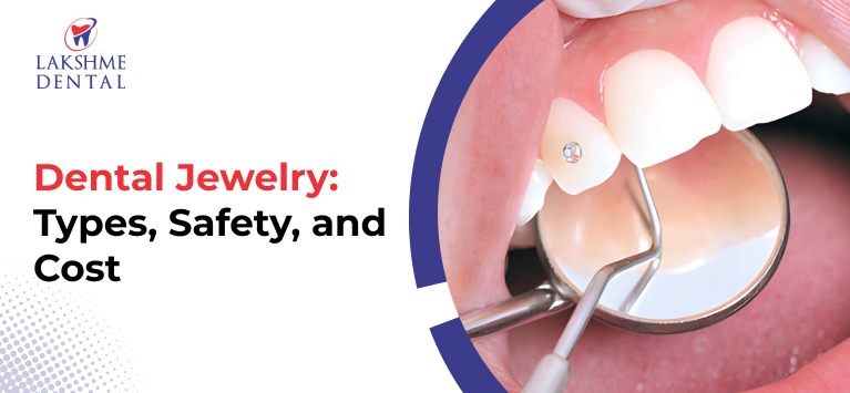 Dental Jewelry