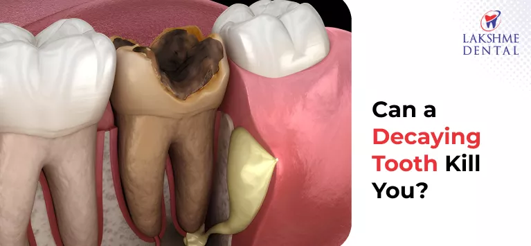 Can a Tooth Infection Kill You?