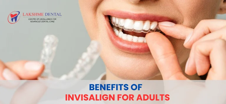 Benefits-of-Invisalign-for-Adults