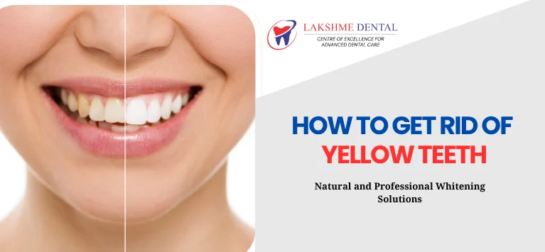 How-to-get-rid-of-yellow-teeth