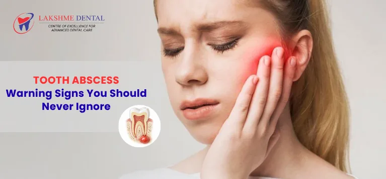 Tooth-Abscess-Warning-Signs-You-Should-Never-Ignore