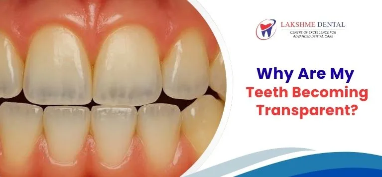 why-are-my-teeth-becoming-transparent